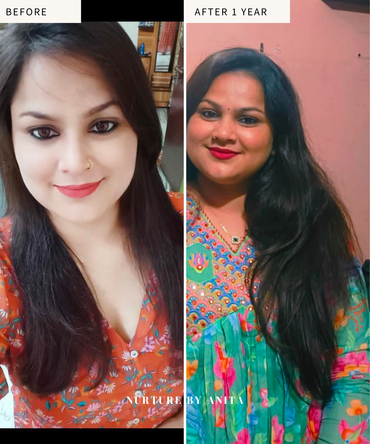 FAQs About Hair Thinning: Causes, Signs & What To Do