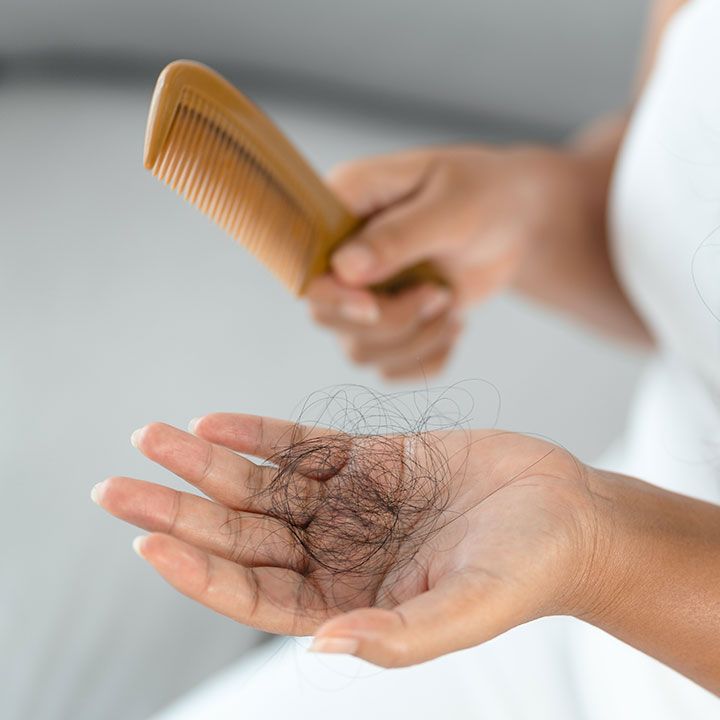 Woman facing hairfall