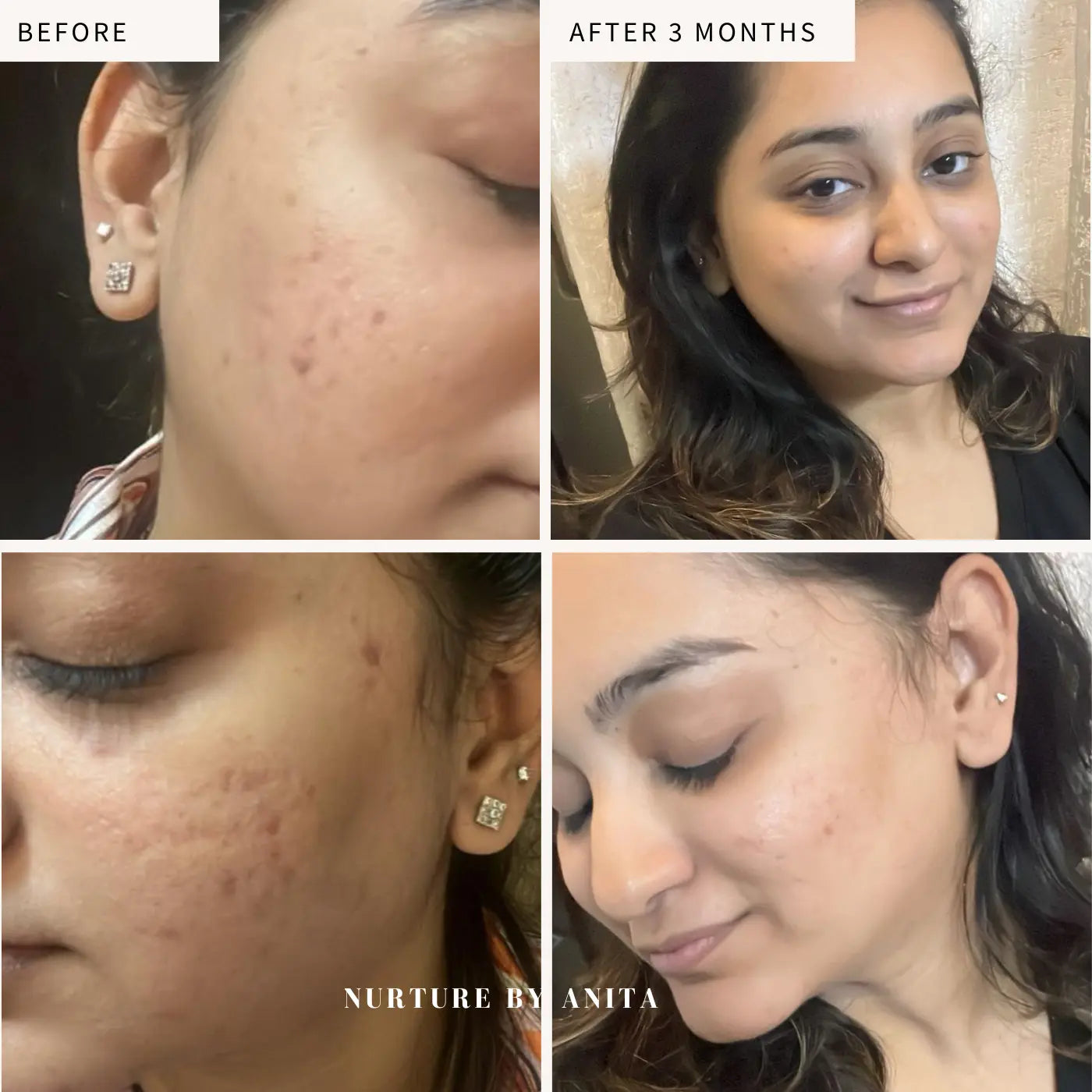 Lemon Rose Face Oil - NURTURE BY ANITA - customer results