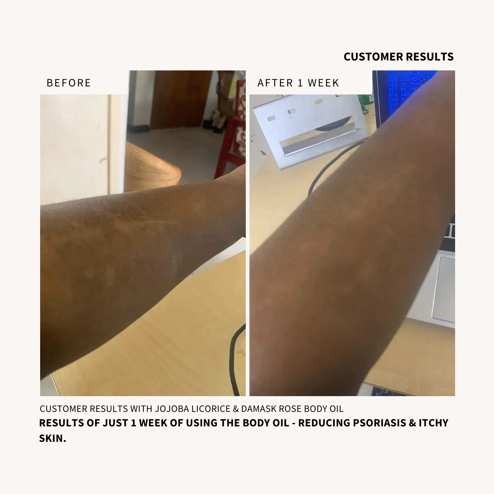 Jojoba Licorice & Damask Rose Body Oil - NURTURE BY ANITA - Golden Jojoba - Skin Barrier Repair - Collagen Boosting Oil - Post Shower Body Oil