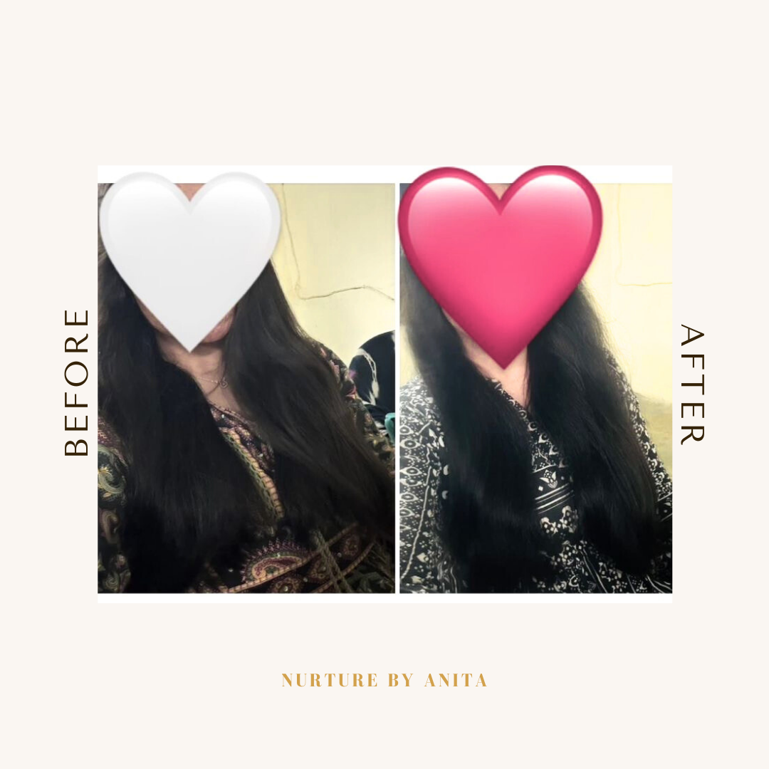 Customer Results - Hair Growth Oil