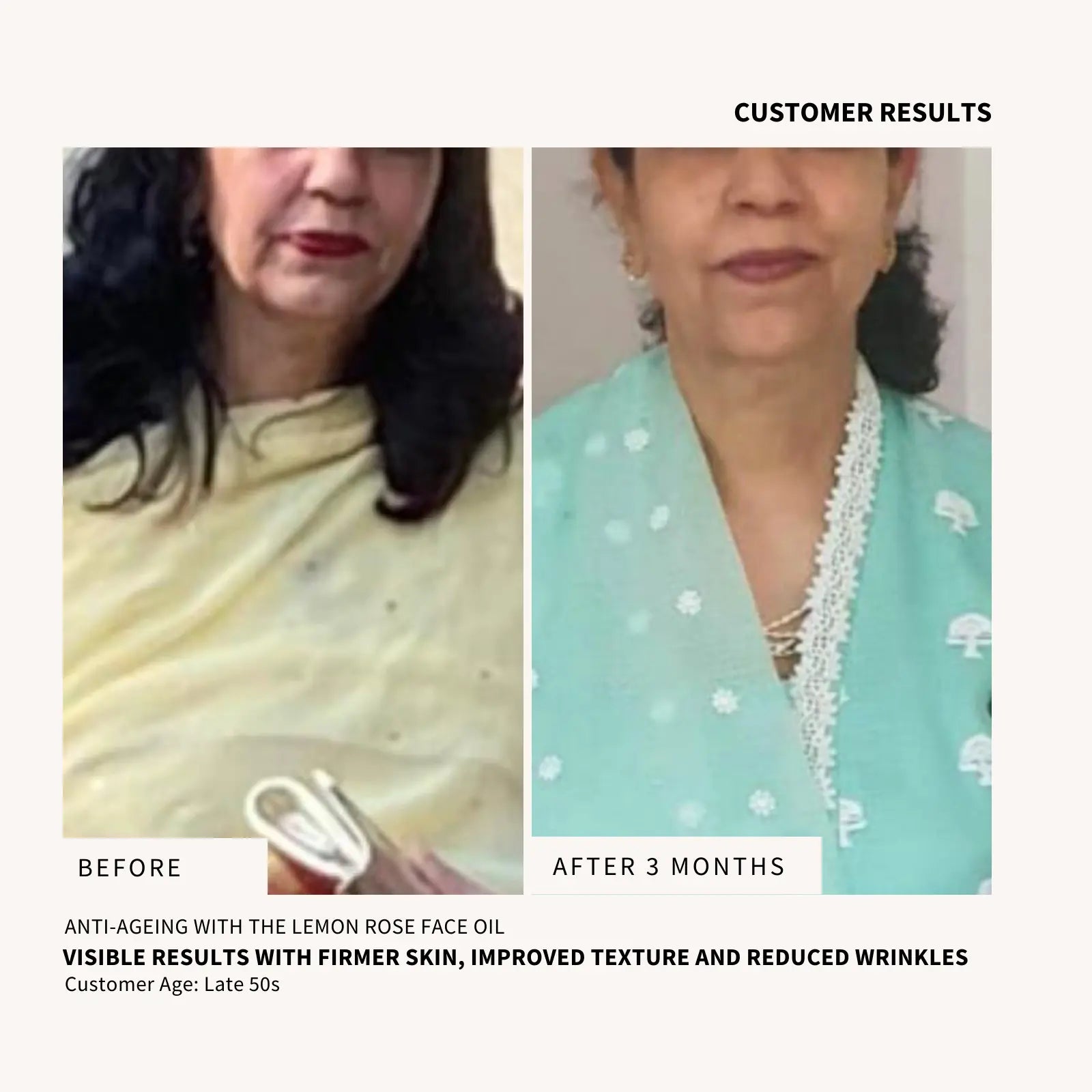 Lemon Rose Face Oil - NURTURE BY ANITA - customer results with anti-aging benefits