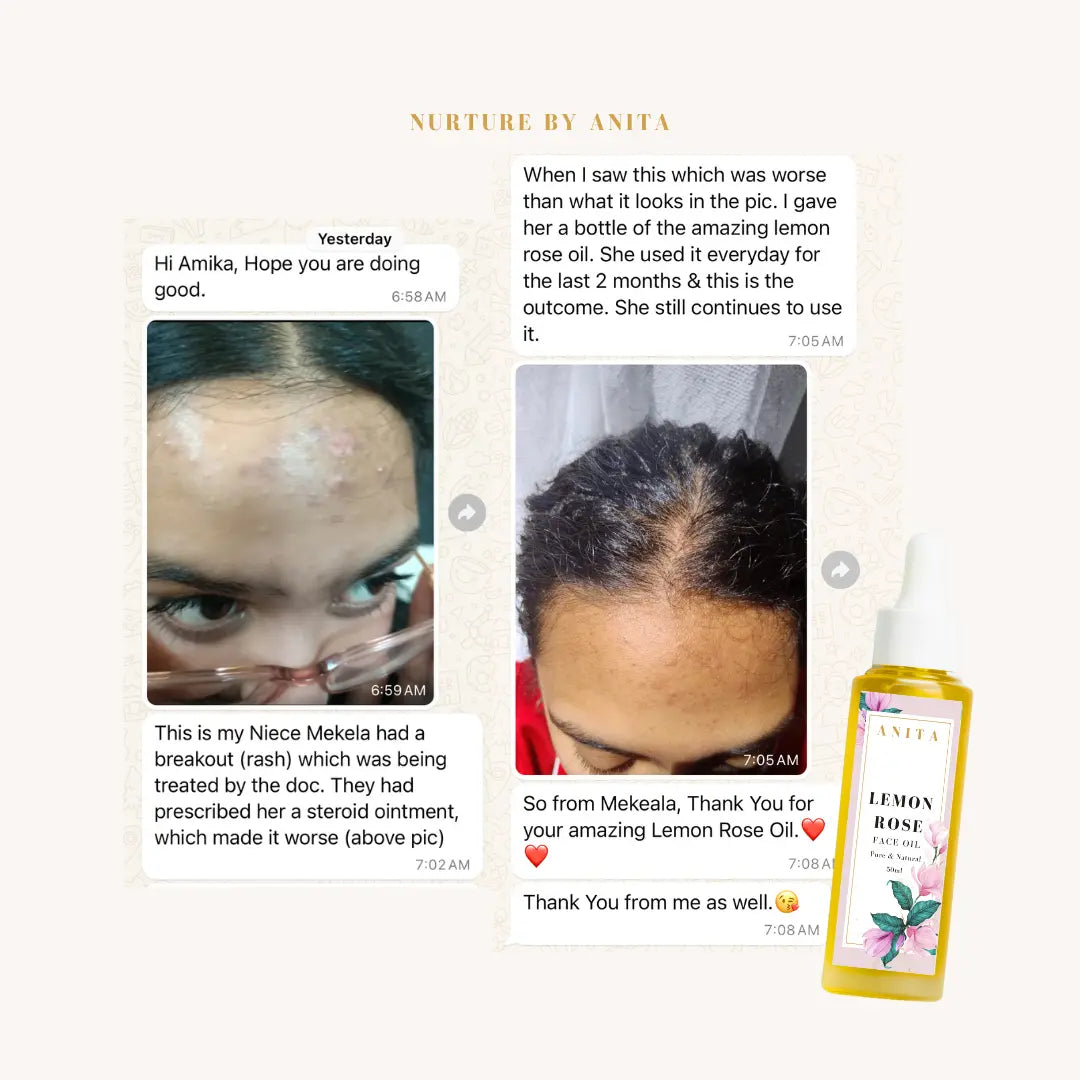 Lemon Rose Face Oil - NURTURE BY ANITA - customer results