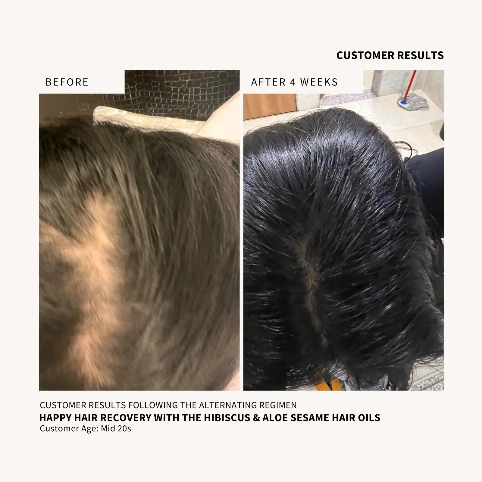 Hair Thinning Customer Results