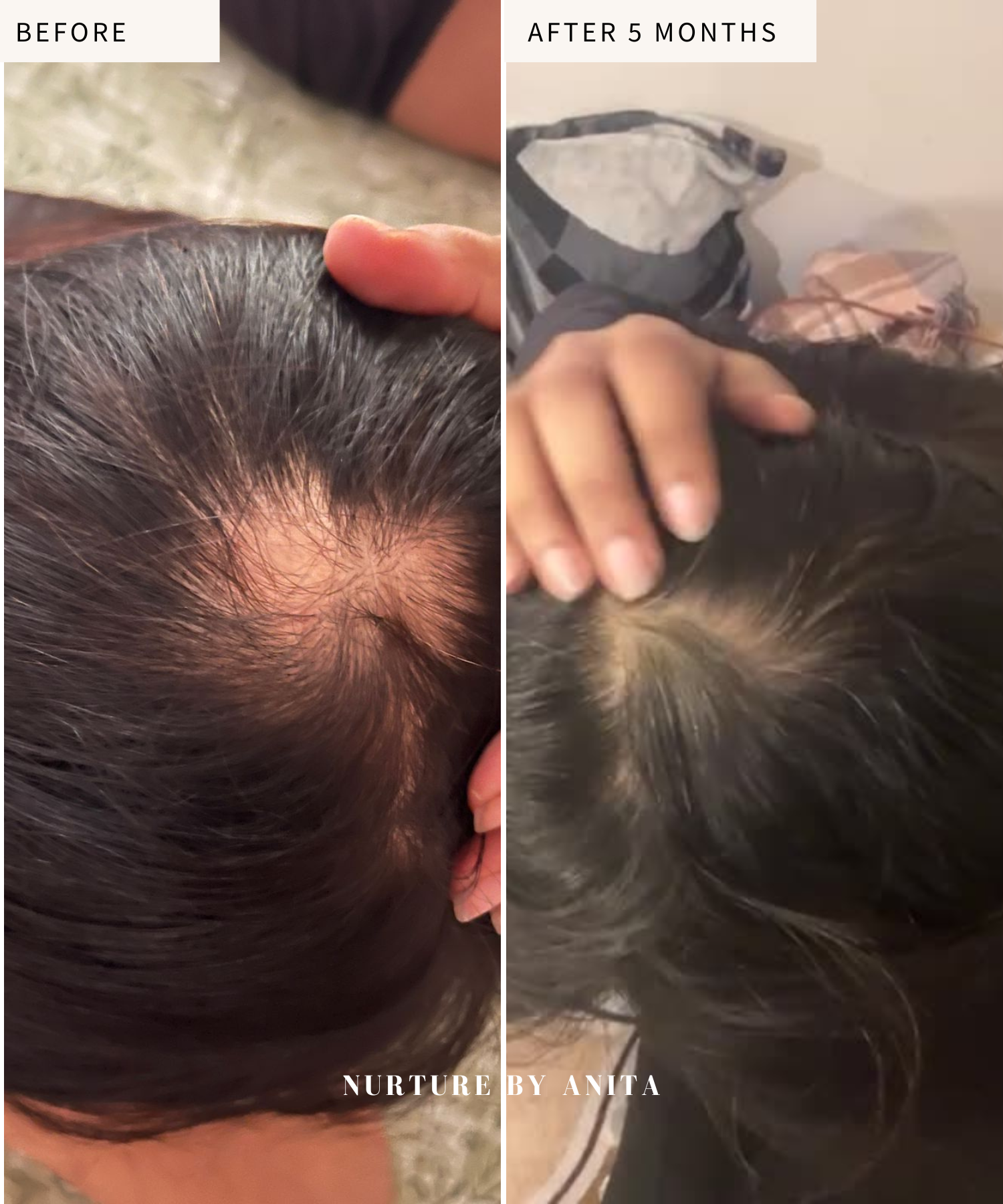 Customer Results - Hair Growth Oil