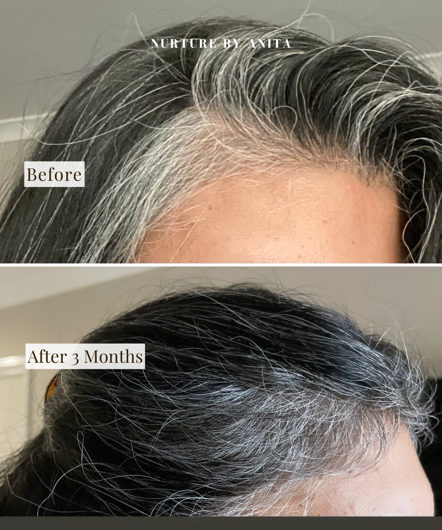 Customer Results - Hair Growth Oil